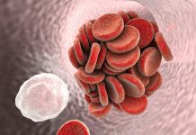 Blodpropp – vanligare hos gravida Blodpropp gravid